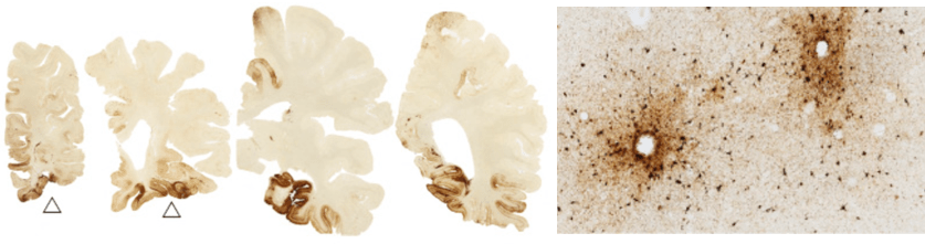 CTE_Fig3