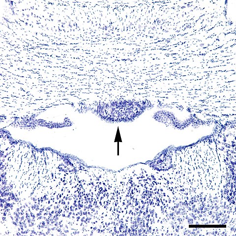480px-Subfornical_organ_of_a_mouse