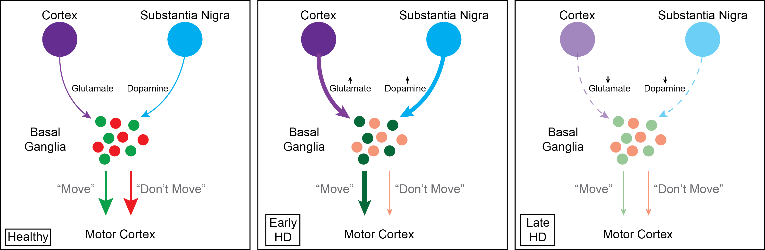 huntingtons basal ganglia