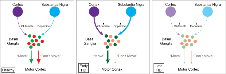 huntingtons basal ganglia