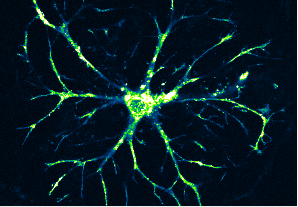Astrocytes: the “stars” of our central nervous system