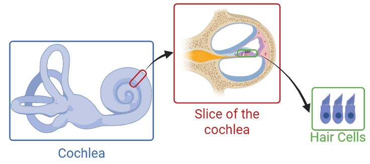 How cochlear implants create sound for the hard of hearing – PennNeuroKnow